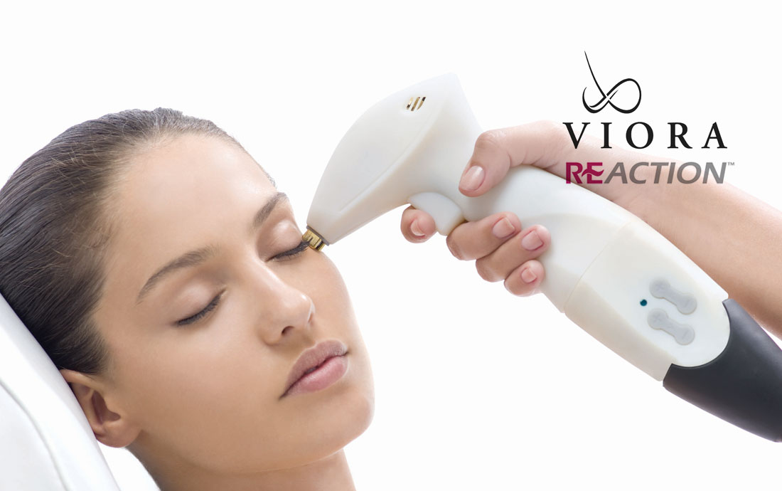 Viora Reaction, radiofrequency skin tightening, face