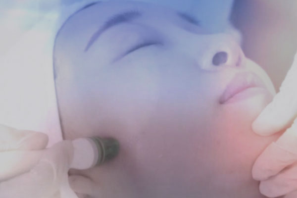 Hydro-Facial, aqua-peeling to hydrate, rejuvenate, deep cleanse and exfoliate